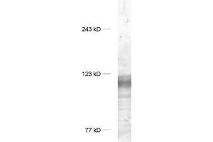 dilution 1 : 1000, sample: synaptic membrane fraction of rat brain (LP1) (DLG1 anticorps  (AA 115-133))