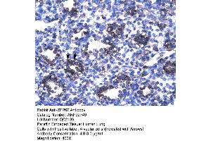 Human Lung (ZBTB7B anticorps  (Middle Region))