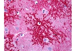 Anti-SLC1A2 / EAAT2 antibody IHC of human brain, astrocytes.