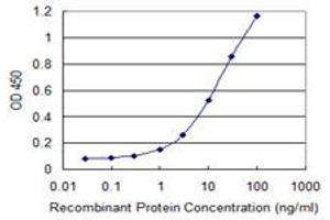 Detection limit for recombinant GST tagged FLVCR1 is 0.
