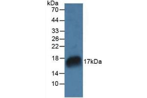 Figure. (RNASE7 anticorps  (AA 31-155))