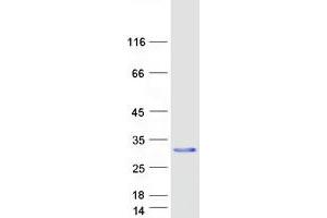 Validation with Western Blot