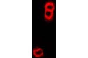 Immunofluorescent analysis of TAP2 staining in U2OS cells.