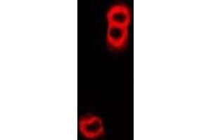 Immunofluorescent analysis of TAP2 staining in U2OS cells.