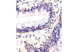 (ABIN652035 and ABIN2840509) staining SOX10 in Human colon tissue sections by Immunohistochemistry (IHC-P - paraformaldehyde-fixed, paraffin-embedded sections).