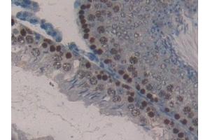 Detection of KLK4 in Rat Testis Tissue using Polyclonal Antibody to Kallikrein 4 (KLK4)