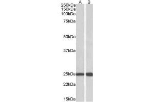 AP23225PU-N RAN antibody staining of Mouse (A) and Rat (B) Testis lysate (35µg protein in RIPA buffer) at 0. (RAN anticorps  (C-Term))