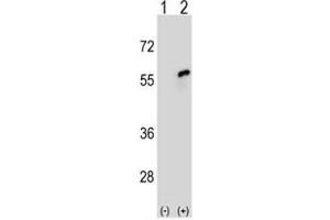 Western blot analysis of CDC20 antibody and 293 cell lysate either nontransfected (Lane 1) or transiently transfected (2) with the CDC20 gene.