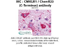 Image no. 1 for anti-Chemokine-Like Receptor 1 (CMKLR1) (C-Term), (Cytoplasmic Domain) antibody (ABIN1733165) (CMKLR1 anticorps  (C-Term, Cytoplasmic Domain))