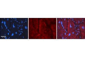 Rabbit Anti-GJC2 Antibody    Formalin Fixed Paraffin Embedded Tissue: Human Adult heart  Observed Staining: Membrane, some cytoplasm Primary Antibody Concentration: 1:100 Secondary Antibody: Donkey anti-Rabbit-Cy2/3 Secondary Antibody Concentration: 1:200 Magnification: 20X Exposure Time: 0.