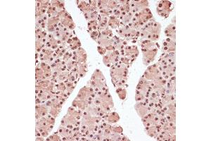 Immunohistochemistry of paraffin-embedded rat pancreas using Phospho--T71 antibody (ABIN3019451, ABIN3019452, ABIN3019453 and ABIN6225376) at dilution of 1:100 (40x lens).