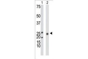 Antibody is used in Western blot to detect KHK in mouse liver tissue lysate (Lane 1) and 293 cell lysate (Lane 2). (Ketohexokinase anticorps  (N-Term))