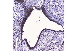 IHC analysis of Cdk6 using anti-Cdk6 antibody (ABIN5692992).