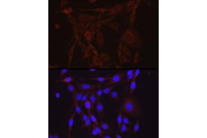 Immunofluorescence analysis of PC-12 cells using SCNN1A Rabbit pAb (ABIN6129465, ABIN6147447, ABIN6147448 and ABIN6221186) at dilution of 1:200 (40x lens).