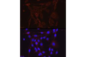 Immunofluorescence analysis of PC-12 cells using SCNN1A Rabbit pAb (ABIN6129465, ABIN6147447, ABIN6147448 and ABIN6221186) at dilution of 1:200 (40x lens). (SCNN1A anticorps  (AA 105-225))