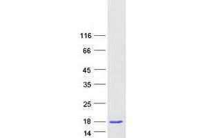 Validation with Western Blot