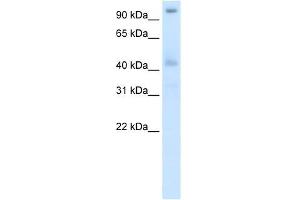 Western Blot showing POGZ antibody used at a concentration of 1-2 ug/ml to detect its target protein. (POGZ anticorps  (N-Term))