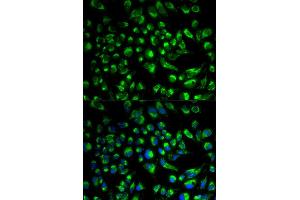 Immunofluorescence analysis of HeLa cell using SPAM1 antibody. (SPAM1 anticorps)