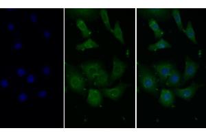 Detection of MCP1 in Human Hela cell using Monoclonal Antibody to Monocyte Chemotactic Protein 1 (MCP1)