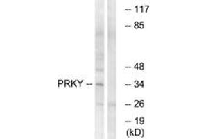Western blot analysis of extracts from Jurkat cells, using PRKY Antibody. (PRKY anticorps  (AA 61-110))