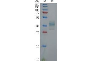 Human GAST Protein, hFc Tag on SDS-PAGE under reducing condition. (Gastrin Protein (GAST) (Fc Tag))