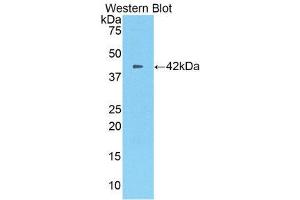 Western Blotting (WB) image for anti-Carboxypeptidase B2 (Plasma) (CPB2) (AA 113-422) antibody (ABIN1860677) (CPB2 anticorps  (AA 113-422))