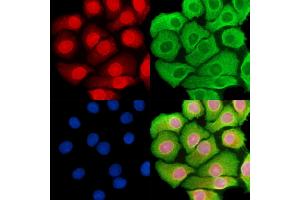 anti-YY2 Transcription Factor (YY2) antibody