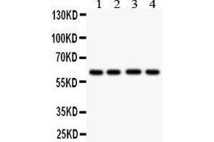 Anti- HEXA antibody,  Western blotting All lanes: Anti HEXA () at 0.