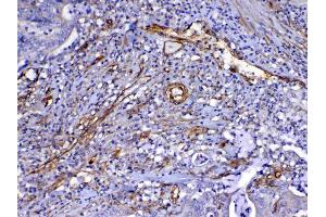 IHC analysis of VEGF Receptor 3 using anti-VEGF Receptor 3 antibody .