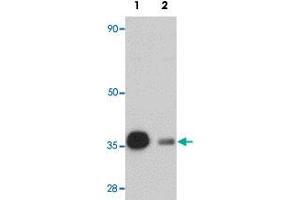 Western blot analysis of rat heart tissue with REEP3 polyclonal antibody  at 1 ug/mL in (Lane 1) the absence and (Lane 2) the presence of blocking peptide. (REEP3 anticorps  (C-Term))