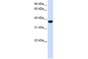 ICMT antibody used at 1 ug/ml to detect target protein. (ICMT anticorps  (Middle Region))