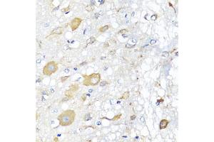 Immunohistochemistry of paraffin-embedded rat brain using CALHM1 antibody (ABIN5975210) at dilution of 1/100 (40x lens). (CALHM1 anticorps)