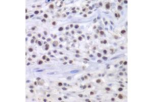 Immunohistochemistry of paraffin-embedded mouse osteosarcoma using HAT1 antibody. (HAT1 anticorps  (AA 245-419))