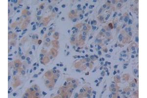 DAB staining on IHC-P; Samples: Human Stomach Tissue (MACC1 anticorps  (AA 522-784))
