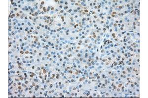 Immunohistochemical staining of paraffin-embedded colon tissue using anti-ERCC1 mouse monoclonal antibody. (ERCC1 anticorps)