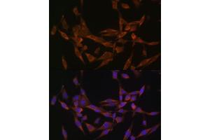 Immunofluorescence analysis of HeLa cells using UBE2O Polyclonal Antibody (ABIN6130342, ABIN6149817, ABIN6149818 and ABIN7101351) at dilution of 1:100 (40x lens).