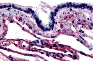 Human Respiratory Epithelium and Alveoli (formalin-fixed, paraffin-embedded) stained with CAV1 antibody ABIN213406 at 4 ug/ml followed by biotinylated goat anti-rabbit IgG secondary antibody ABIN481713, alkaline phosphatase-streptavidin and chromogen. (Caveolin-1 anticorps  (N-Term))