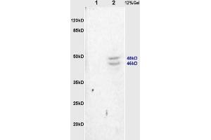 L1 rat heart, L2 rat brain lysates probed (ABIN754888) at 1:200 in 4 °C.