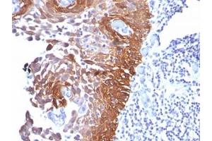 IHC testing of human skin stained with Cytokeratin 17 antibody (E3). (KRT17 anticorps)