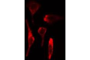 ABIN6269324 staining HeLa cells by IF/ICC. (LIPE anticorps  (Internal Region))