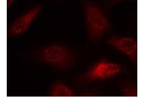Image no. 2 for anti-Amyloid beta (A4) Precursor Protein (APP) (AA 666-670) antibody (ABIN197432) (APP anticorps  (AA 666-670))