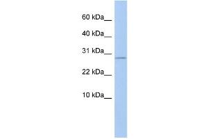 WB Suggested Anti-ANKRD7 Antibody Titration: 0. (ANKRD7 anticorps  (Middle Region))