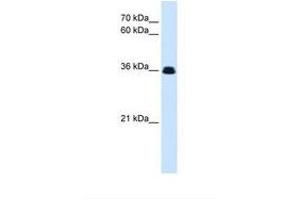 Image no. 1 for anti-EVX1 (EVX1) (N-Term) antibody (ABIN6738407)
