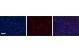 Rabbit Anti-S100A8 Antibody Catalog Number: ARP61367_P050 Formalin Fixed Paraffin Embedded Tissue: Human Heart Tissue Observed Staining: Cytoplasm in endothelial cells in capillaries Primary Antibody Concentration: N/A Other Working Concentrations: 1:600 Secondary Antibody: Donkey anti-Rabbit-Cy3 Secondary Antibody Concentration: 1:200 Magnification: 20X Exposure Time: 0. (S100A8 anticorps  (Middle Region))