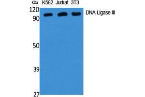 Western Blot (WB) analysis of specific cells using DNA Ligase III Polyclonal Antibody. (LIG3 anticorps  (Internal Region))