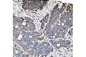 IHC analysis of PMPCA/INPP5 using anti-PMPCA/INPP5 antibody (ABIN7602722). (PMPCA anticorps  (AA 99-525))