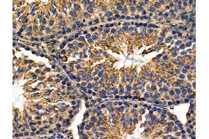 ABIN6257398 and ABIN6276108 at 1/100 staining Mouse testis tissue by IHC-P. (Rho-related GTP-binding protein anticorps)