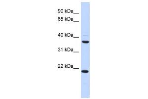 Western Blotting (WB) image for anti-Transmembrane Protein 74 (TMEM74) antibody (ABIN2459633) (TMEM74 anticorps)