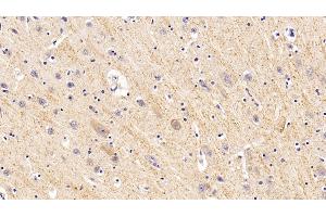 Detection of GLb in Human Cerebrum Tissue using Polyclonal Antibody to Galactosidase Beta (GLb)