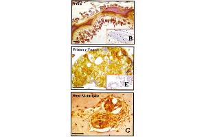 Immunohistochemistry image of BSP staining in paraffn sections of human tissues. (BSP anticorps)